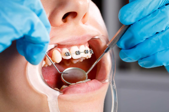 clip-main Crown & Bridge Dentals in madurai
